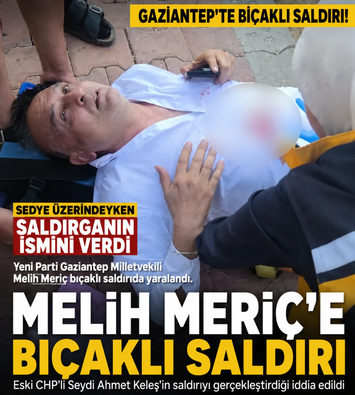 Gaziantep Milletvekili Melih Meri&ccedil; Bı&ccedil;aklı Saldırıda Yaralandı: Sedye &Uuml;zerinde İsim Verdi