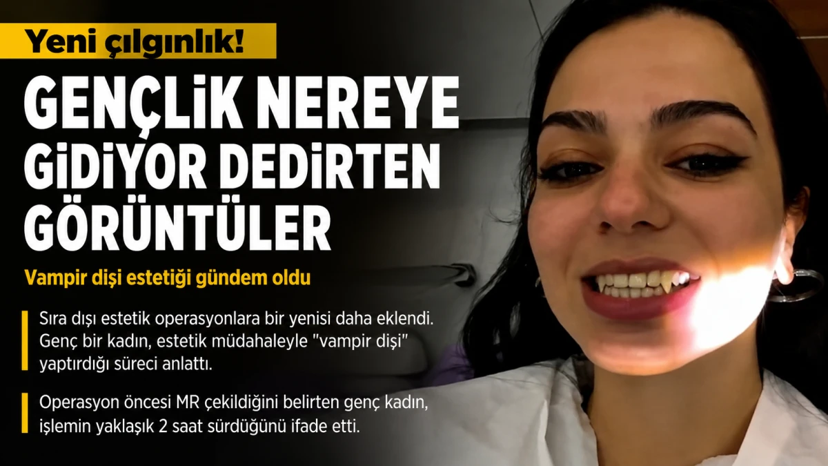 Vampir Dişi Estetiği Sosyal Medyada G&uuml;ndem Oldu: İşlem Yaklaşık 2 Saat S&uuml;r&uuml;yor